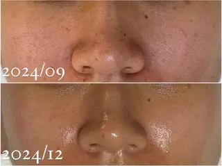 田中For..天王寺 肌質改善/よもぎ蒸しのエステ・リラクイメージ