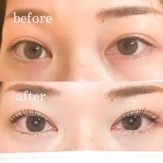 マツエク・マツパ Dimples所属・Dimples ERINAのエステ・リラクイメージ