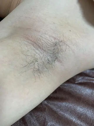 メンズ キッズ 脱毛SALON RaYNiCKのエステ・リラクイメージ