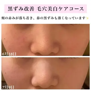 Bellesthe (ベルエステ)のエステ・リラクイメージ