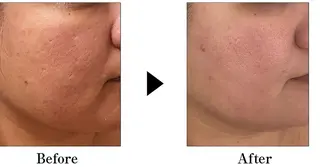 マツエク・マツパ パーマ ネイル キッズ メンズ ミディアム 次世代まつげパーマは 『リベル名古屋』のマツエク・マツパデザイン