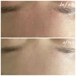 メンズ メナード岐阜茜部 杉浦のエステ・リラクイメージ