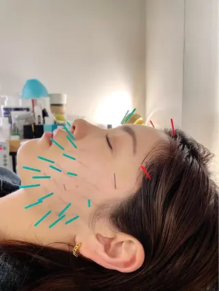 小顔美容鍼専門サロン 渋谷YZのエステ・リラクイメージ