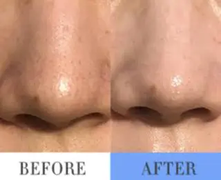 美容マッサージ Urichのエステ・リラクイメージ