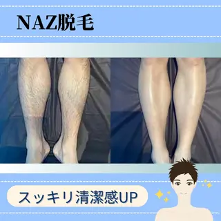 NAZ  (ナーズ)のエステ・リラクイメージ