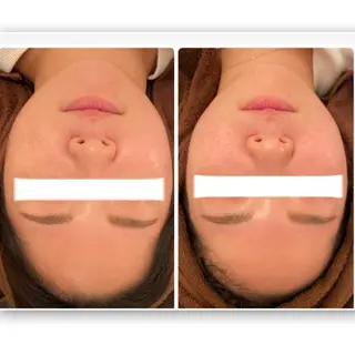 FLEUR大阪・美容 整体・痩身・小顔のエステ・リラクイメージ