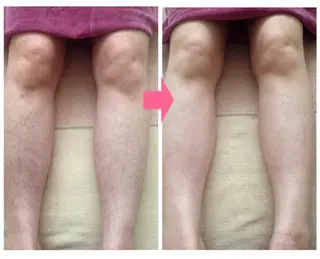 脱毛＆肌質改善サロン shandeelのエステ・リラクイメージ