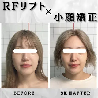 小顔矯正専門店 ❤️池田 桃花のエステ・リラクイメージ