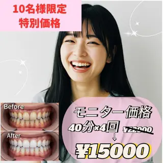 ホワイトニングサロン nico西葛西店のその他イメージ