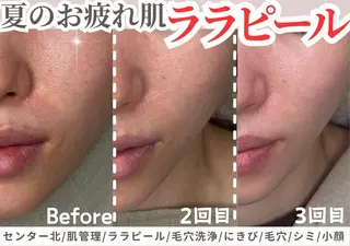 sii センター北 AIのエステ・リラクイメージ