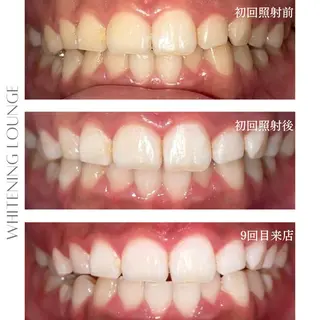 ホワイトニングラウンジ横須賀所属・ホワイトニング Lounge横須賀のその他イメージ