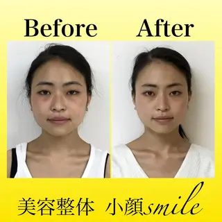 【小顔・姿勢矯正】 美容整体 SMILEのエステ・リラクイメージ