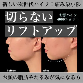 アイブロウ/脱毛/ 肌質改善🌷RINAの眉毛・アイブロウイメージ