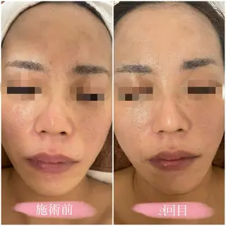 Voyage serein 【ヴォヤージュスラン】所属・心斎橋　Voyage serein🌙のマツエク・マツパデザイン