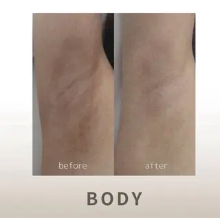 小顔/たるみ/黒ずみ除去専門サロン/SONA 大和西大寺店所属・【小顔専門看護師 サロンSONA】のエステ・リラクイメージ