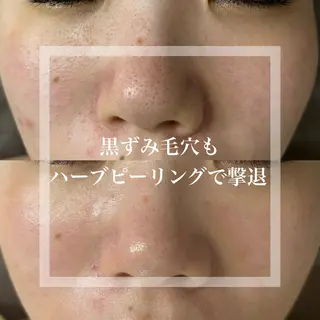 WHITE AQUA 北千住店のエステ・リラクイメージ