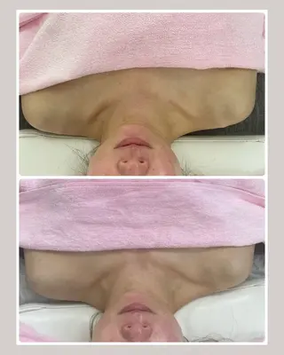 Salon Rion所属・Rion 野々村のエステ・リラクイメージ