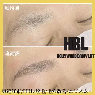 アイブロウ epismoo 脱毛/HBL/毛穴の眉毛・アイブロウイメージ