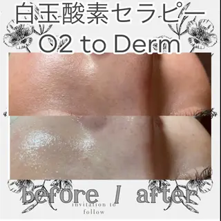 crescent所属・【韓国肌管理・脱毛】 クレセントのエステ・リラクイメージ