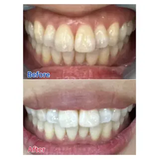 MBEAUTYSALON 千葉店・京成大久保所属・Melty 輝のその他イメージ