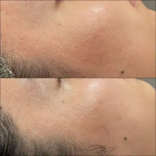 LiZA エステティックサロンのエステ・リラクイメージ