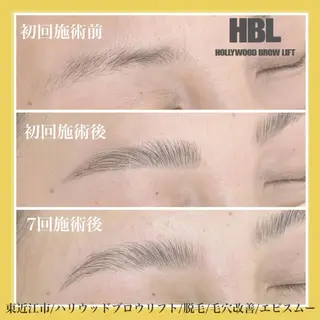 アイブロウ epismoo 脱毛/HBL/毛穴の眉毛・アイブロウイメージ