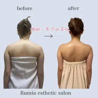 Rumia esthetic salon所属・Rumia emi🧸のエステ・リラクイメージ