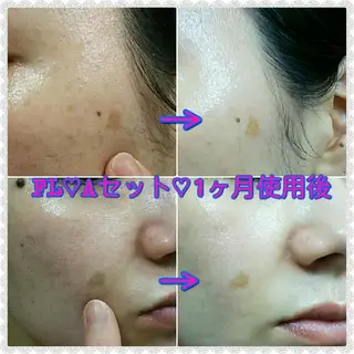 メナード水戸見川店 MENARD所属・黒坂 リカのその他イメージ