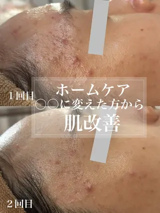 WHITE AQUA 北千住店のエステ・リラクイメージ