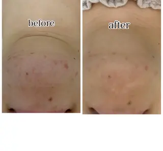 総合エステサロン 肌活のエステ・リラクイメージ