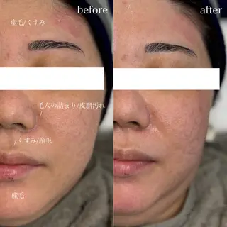 アイブロウ WHITEEYE堺東 店長/藁粥　明の眉毛・アイブロウイメージ