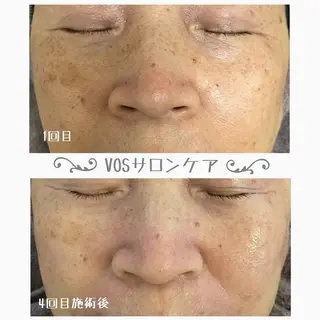 1ヶ月後も半分残る 高持続LEDエクステのマツエク・マツパデザイン