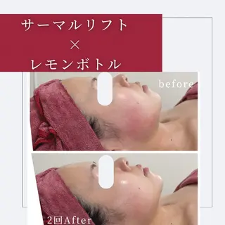 小顔矯正専門店 ❤️池田 桃花のエステ・リラクイメージ