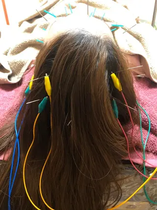 美容鍼灸女性専用 りんご鍼灸治療院のその他イメージ