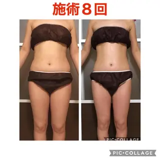 セミロング カラー パーマ ヘアアレンジ メンズ キッズ ネイル マツエク・マツパ アニメ,Vオタク× 即効痩せエステサロンのエステ・リラクイメージ