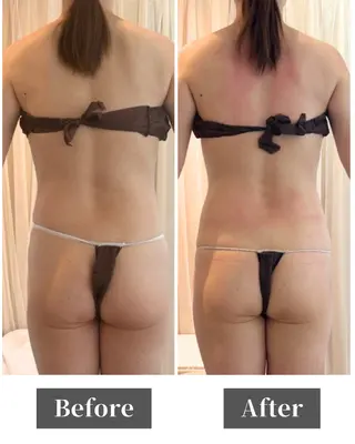 姿勢矯正専門店Asmy天王寺店所属・Asmy 天王寺のエステ・リラクイメージ