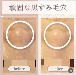 看護師が施術する ナスサロ/Emi🪽のエステ・リラクイメージ