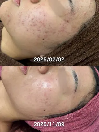 Colore(クロレ) リラクゼーション＆ビューティー エステティックサロン所属・Colore haraのエステ・リラクイメージ