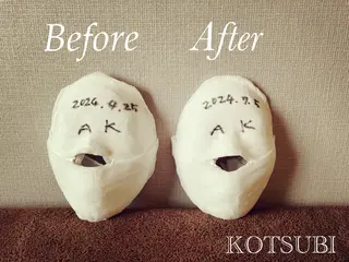 小顔矯正コルギ KOTSUBIのその他イメージ
