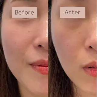 べアール所属・小顔/毛穴/白玉肌 salon bealのその他イメージ