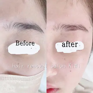アイブロウ 脱毛サロン KiWiのエステ・リラクイメージ