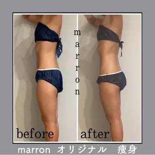 marron所属・痩身ハイパーナイフ ララピールリアボーテのエステ・リラクイメージ