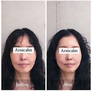 ハーブピーリング 肌再生ピーリング/のエステ・リラクイメージ