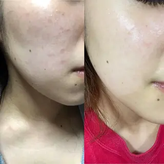 CEサロンbelle mona所属・CEサロン belle monaのエステ・リラクイメージ