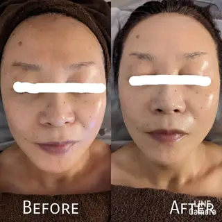 フェイシャルエステ ラトゥール伊深のエステ・リラクイメージ