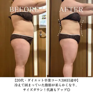 【三軒茶屋/下馬】 本格痩身・よもぎ蒸しのエステ・リラクイメージ