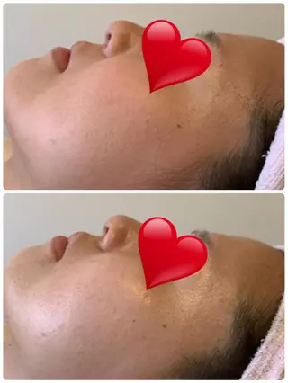 espoir エスポワールのネイルデザイン