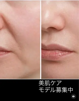 ✨オール年代🆗 🍒酒井芳美🐹のエステ・リラクイメージ