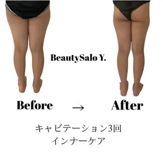 ダイエット専門店 Y.【ワイドット】のエステ・リラクイメージ