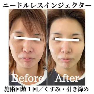 トータルビューティー サロンSalaのマツエク・マツパデザイン